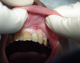 �������ȁE�C���v�����g���̂��������ȃN���j�b�N�]����