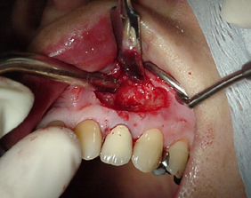 �������ȁE�C���v�����g���̂��������ȃN���j�b�N�]����