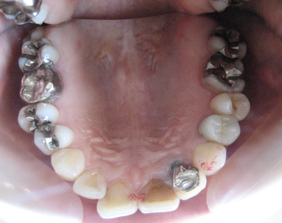 �������ȁE�C���v�����g���̂��������ȃN���j�b�N�]����