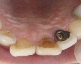 �������ȁE�C���v�����g���̂��������ȃN���j�b�N�]����