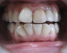 �������ȁE�C���v�����g���̂��������ȃN���j�b�N�]����