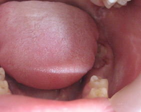 �������ȁE�C���v�����g���̂��������ȃN���j�b�N�]����