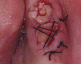 �������ȁE�C���v�����g���̂��������ȃN���j�b�N�]����