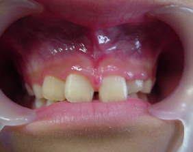 �������ȁE�C���v�����g���̂��������ȃN���j�b�N�]����