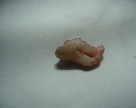 �������ȁE�C���v�����g���̂��������ȃN���j�b�N�]����