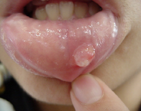 �������ȁE�C���v�����g���̂��������ȃN���j�b�N�]����