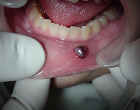 �������ȁE�C���v�����g���̂��������ȃN���j�b�N�]����