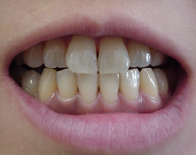 �������ȁE�C���v�����g���̂��������ȃN���j�b�N�]����