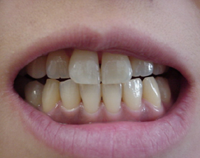 �������ȁE�C���v�����g���̂��������ȃN���j�b�N�]����