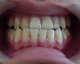 �������ȁE�C���v�����g���̂��������ȃN���j�b�N�]����