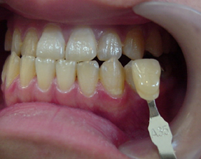 �������ȁE�C���v�����g���̂��������ȃN���j�b�N�]����