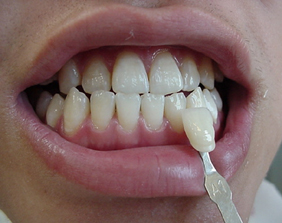 �������ȁE�C���v�����g���̂��������ȃN���j�b�N�]����