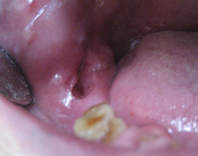 �������ȁE�C���v�����g���̂��������ȃN���j�b�N�]����