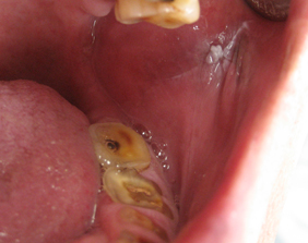 �������ȁE�C���v�����g���̂��������ȃN���j�b�N�]����