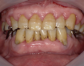 �������ȁE�C���v�����g���̂��������ȃN���j�b�N�]����