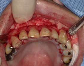 �������ȁE�C���v�����g���̂��������ȃN���j�b�N�]����