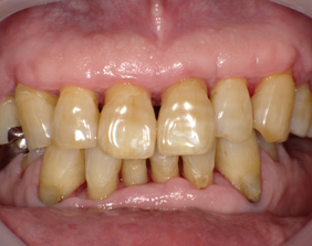 �������ȁE�C���v�����g���̂��������ȃN���j�b�N�]����