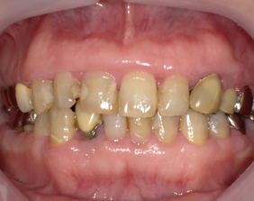 �������ȁE�C���v�����g���̂��������ȃN���j�b�N�]����