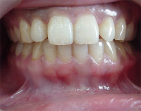 �������ȁE�C���v�����g���̂��������ȃN���j�b�N�]����